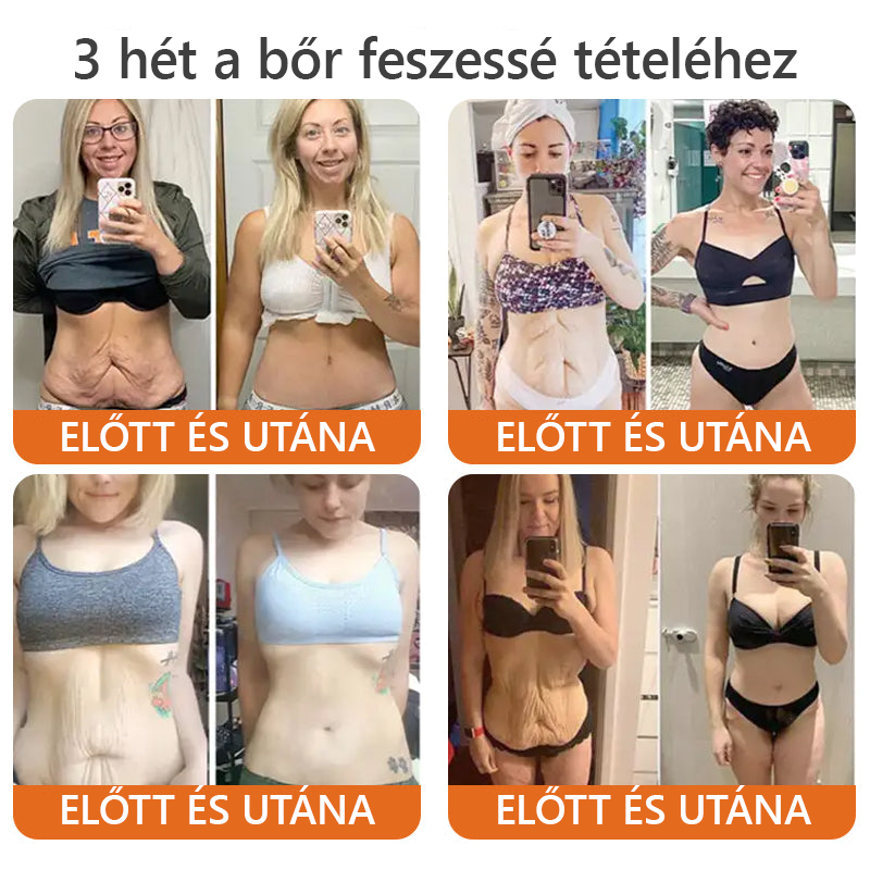 ✨ TLOPA® Méhméreg Bőr Helyreállító Krém 🔥 Amerikai fejlesztés, magyarországi gyártás és szállítás