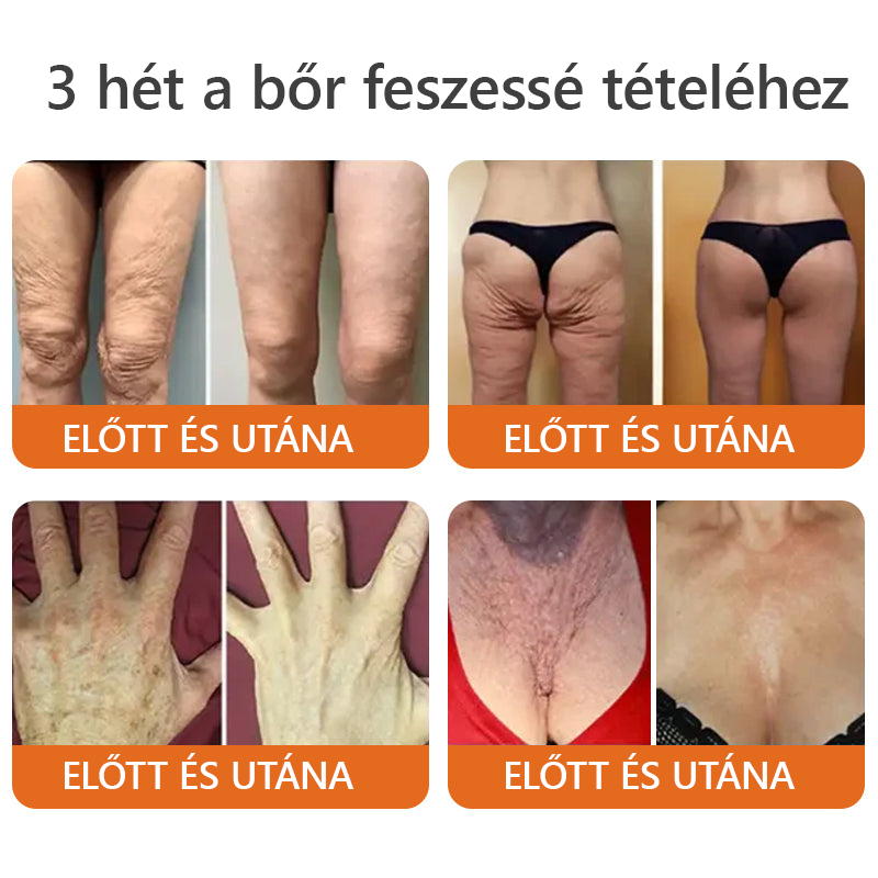 ✨ TLOPA® Méhméreg Bőr Helyreállító Krém 🔥 Amerikai fejlesztés, magyarországi gyártás és szállítás