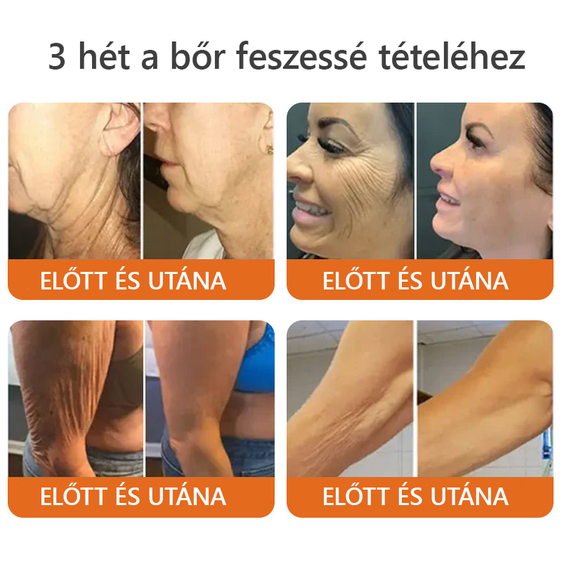 ✨ TLOPA® Méhméreg Bőr Helyreállító Krém 🔥 Amerikai fejlesztés, magyarországi gyártás és szállítás