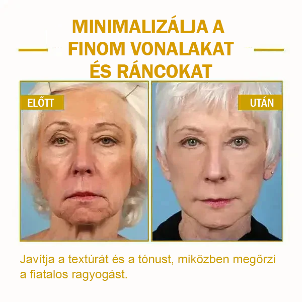 🌟🌟Utolsó napi kedvezmény: 80% KEDVEZMÉNY LEFUN® bőrfeszesítő fiatalító olaj