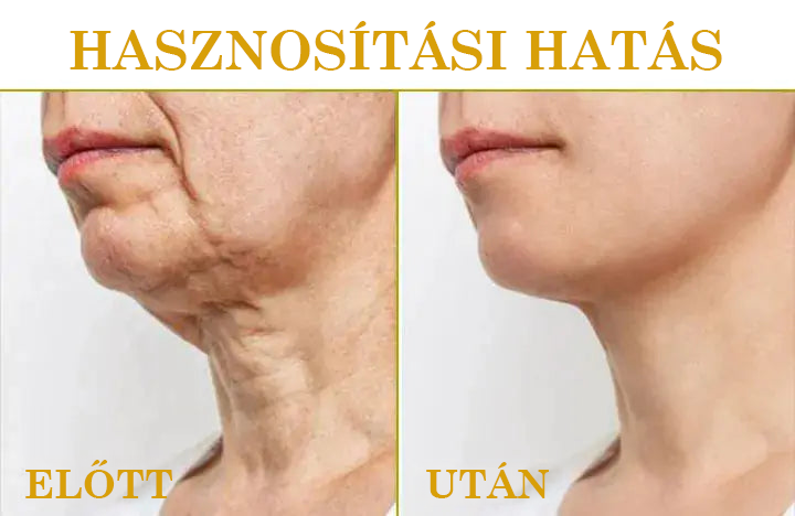🌟🌟Utolsó napi kedvezmény: 80% KEDVEZMÉNY LEFUN® bőrfeszesítő fiatalító olaj