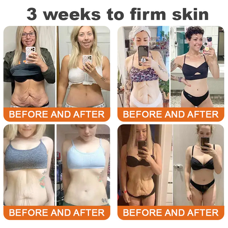 flysmus™ Botox Bee Venom bőrfeszesítő szérumstick (🔥Utolsó NAP 70% KEDVEZMÉNY)💄