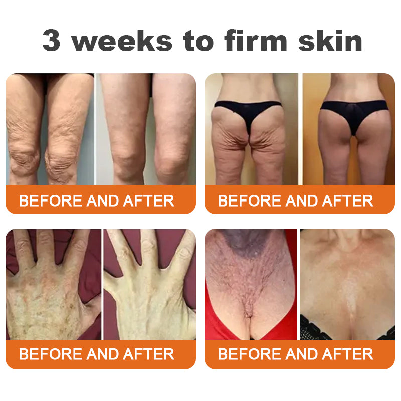 flysmus™ Botox Bee Venom bőrfeszesítő szérumstick (🔥Utolsó NAP 70% KEDVEZMÉNY)💄