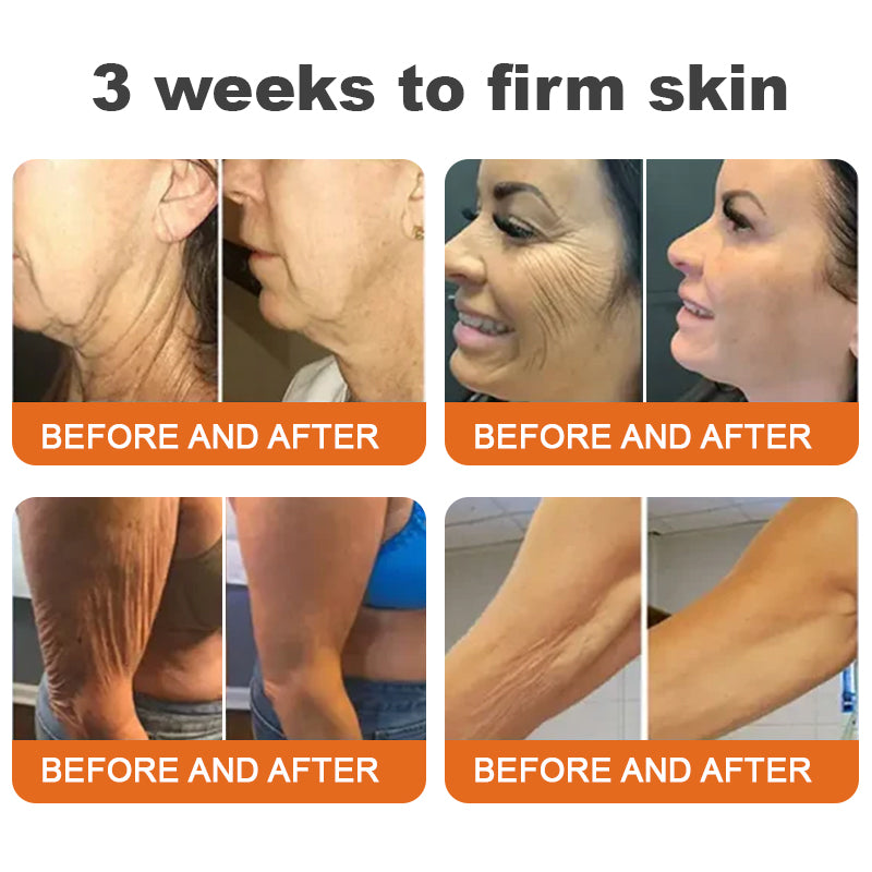flysmus™ Botox Bee Venom bőrfeszesítő szérumstick (🔥Utolsó NAP 70% KEDVEZMÉNY)💄