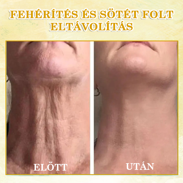 🌟🌟Utolsó napi kedvezmény: 80% KEDVEZMÉNY LEFUN® bőrfeszesítő fiatalító olaj