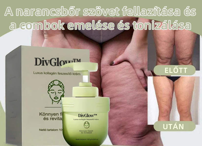 𝐃𝐢𝐯𝐆𝐥𝐨𝐰™𝐋𝐮𝐱𝐮𝐬 𝐤𝐨𝐥𝐥𝐚𝐠é𝐧 𝐟𝐞𝐬𝐳𝐞𝐬í𝐭ő 𝐤𝐫é𝐦🌱🌱