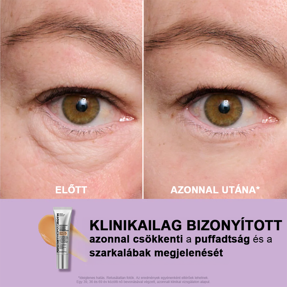 đžAzonnali SzemkörnyĂ©k-FeszesĂtĆ KönnyƱ Formula â VĂ©gsĆ EmelĂ©s Ă©s Sima BefejezĂ©s âš