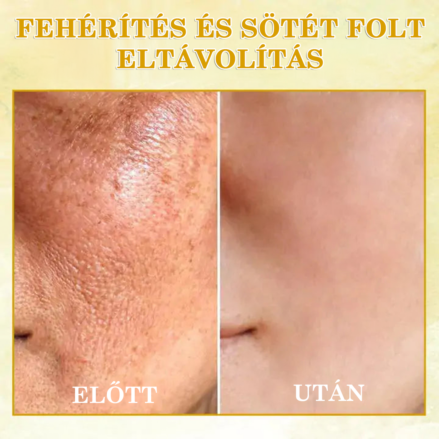 🌟🌟Utolsó napi kedvezmény: 80% KEDVEZMÉNY LEFUN® bőrfeszesítő fiatalító olaj