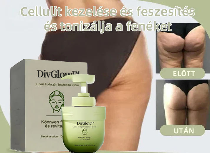 𝐃𝐢𝐯𝐆𝐥𝐨𝐰™𝐋𝐮𝐱𝐮𝐬 𝐤𝐨𝐥𝐥𝐚𝐠é𝐧 𝐟𝐞𝐬𝐳𝐞𝐬í𝐭ő 𝐤𝐫é𝐦🌱🌱