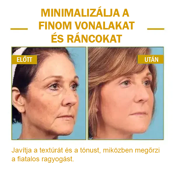 🌟🌟Utolsó napi kedvezmény: 80% KEDVEZMÉNY LEFUN® bőrfeszesítő fiatalító olaj