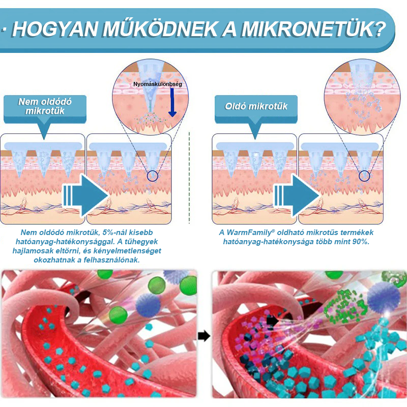 WarmFamily® SMGT-GLP-1 Nano Mikrotű Tapasz Kollagénnel és Matrixyl 3000-rel ✅ | Klinikailag bizonyított hatás fogyásra, szív- és érrendszeri egészségre, cukorbetegségre és egyéb egészségügyi problémákra, orvosok által ajánlott 👨⚕️