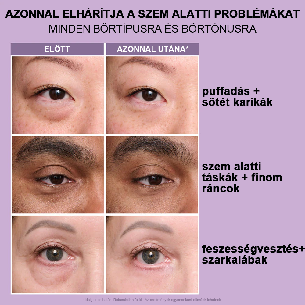 đžAzonnali SzemkörnyĂ©k-FeszesĂtĆ KönnyƱ Formula â VĂ©gsĆ EmelĂ©s Ă©s Sima BefejezĂ©s âš