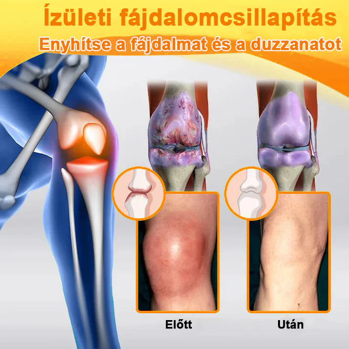 ✅ Hivatalos áruház: Ourlyard™ Magnéziumolaj és Mézes Ízületjavító Spray 👨‍⚕️ Jóváhagyva a Magyar Gyógyszerészeti és Egészségügyi Minőség- és Szervezetfejlesztési Intézet (OGYÉI) által. 🔥🔥🔥