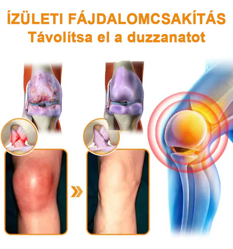 ✅ Hivatalos áruház: Ourlyard™ Magnéziumolaj és Mézes Ízületjavító Spray 👨‍⚕️ Jóváhagyva a Magyar Gyógyszerészeti és Egészségügyi Minőség- és Szervezetfejlesztési Intézet (OGYÉI) által. 🔥🔥🔥
