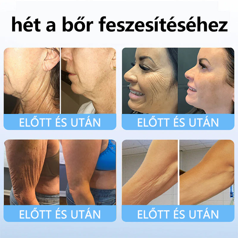 TLOPA™ Kollagén Peptid Erősítő Szérum Stift✨-Az Országos Népegészségügyi Intézet [NNK] és a Magyar Bőrgyógyászati Társaság [MDDK] ajánlásával.