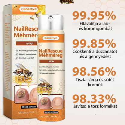 2025🎁 Korlátozott idejű akció 70% kedvezménnyel ️️⏳ Ceoerty® körömgomba spray méhméreggel 💥 2 hét alatt megoldja az összes körömproblémát