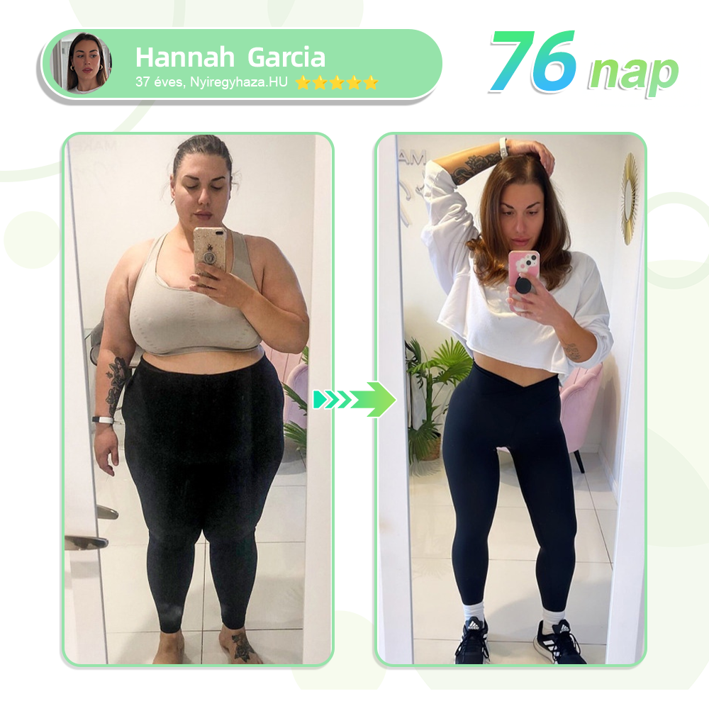 𝗧𝗟𝗢𝗣𝗔® 𝗚𝗜𝗣+𝗚𝗟𝗣-1 Nano Mikrotűs Tapasz👩‍⚕️ (Fájdalommentes, hosszan tartó hatás, a cukorbetegség, elhízás és szív- és érrendszeri betegségek kezelésére)✅