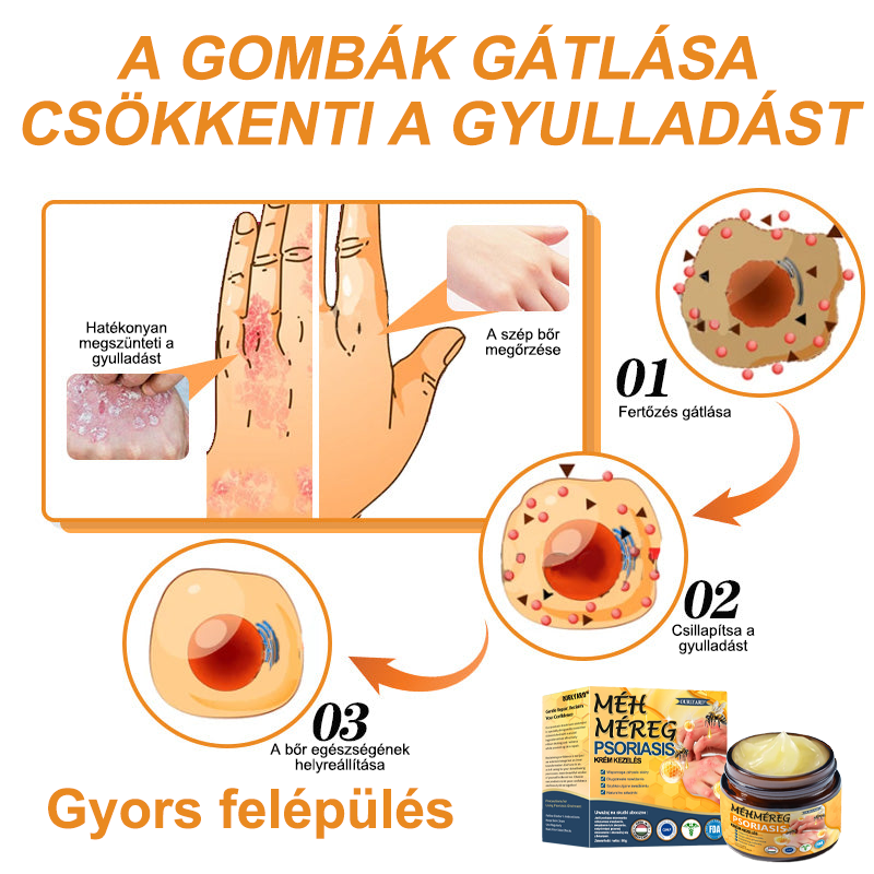 Ourlyard™ Méhméreg Haladó Psoriasis Kezelő Kenőcs (👨Orvos által ajánlott)