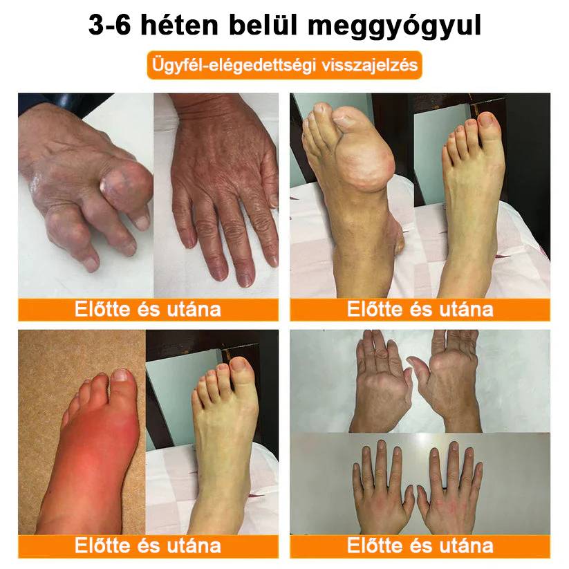 ✅ Hivatalos áruház: Ourlyard™ Magnéziumolaj és Mézes Ízületjavító Spray 👨‍⚕️ Jóváhagyva a Magyar Gyógyszerészeti és Egészségügyi Minőség- és Szervezetfejlesztési Intézet (OGYÉI) által. 🔥🔥🔥