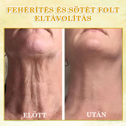 🌟🌟Utolsó napi kedvezmény: 80% KEDVEZMÉNY LEFUN® bőrfeszesítő fiatalító olaj
