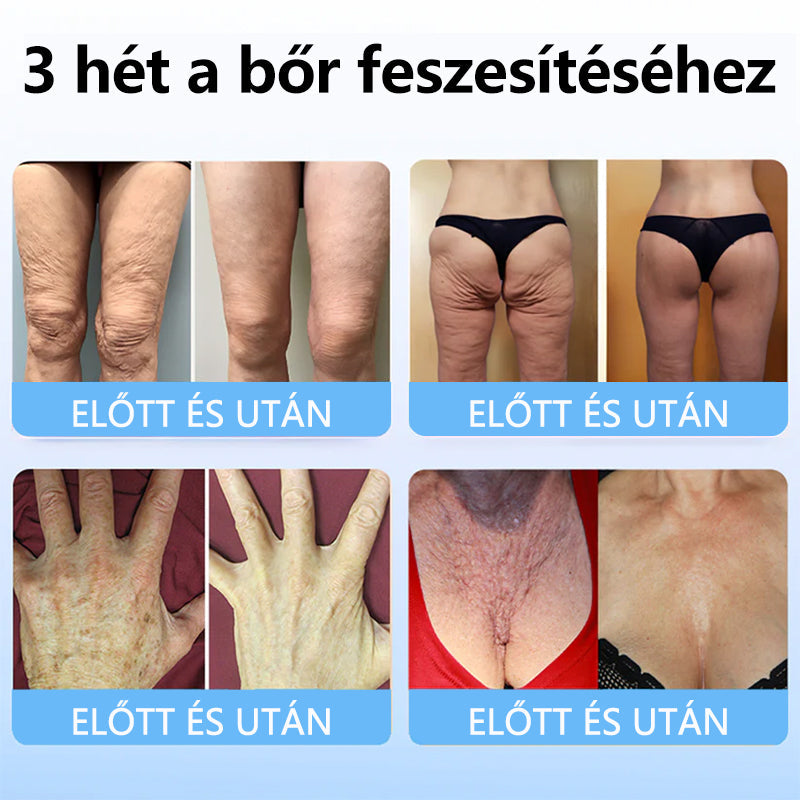 TLOPA™ Kollagén Peptid Erősítő Szérum Stift✨-Az Országos Népegészségügyi Intézet [NNK] és a Magyar Bőrgyógyászati Társaság [MDDK] ajánlásával.