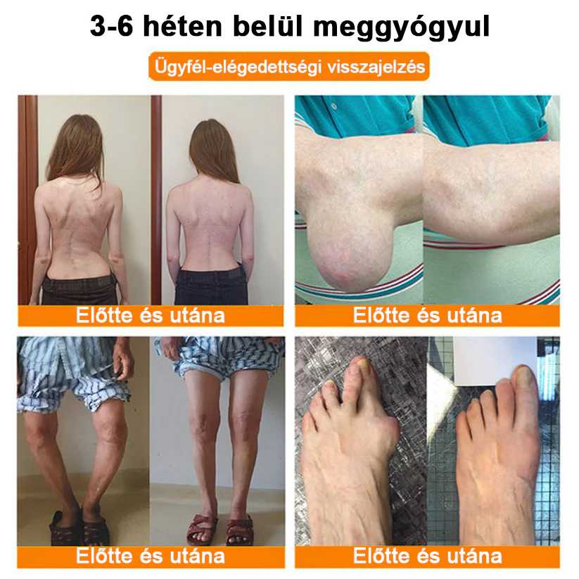 ✅ Hivatalos áruház: Ourlyard™ Magnéziumolaj és Mézes Ízületjavító Spray 👨‍⚕️ Jóváhagyva a Magyar Gyógyszerészeti és Egészségügyi Minőség- és Szervezetfejlesztési Intézet (OGYÉI) által. 🔥🔥🔥