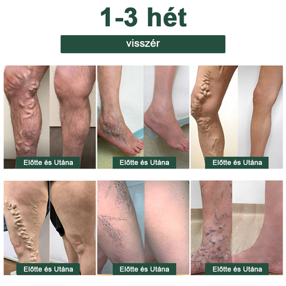 🔥 Már csak 5 üveg maradt! További 50% kedvezményt biztosítunk! Szerezzen magának egy egészséges testet. Ha most hiányzik, csak jövőre kapja meg.