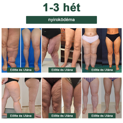 🔥 Már csak 5 üveg maradt! További 50% kedvezményt biztosítunk! Szerezzen magának egy egészséges testet. Ha most hiányzik, csak jövőre kapja meg.