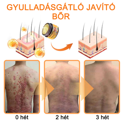 Ourlyard™ Méhméreg Haladó Psoriasis Kezelő Kenőcs (👨Orvos által ajánlott)