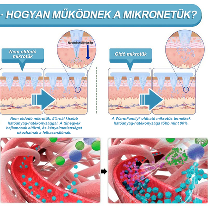 WarmFamily® SMGT-GLP-1 Nano Mikrotű Tapasz Kollagénnel és Matrixyl 3000-rel ✅ | Klinikailag bizonyított hatás fogyásra, szív- és érrendszeri egészségre, cukorbetegségre és egyéb egészségügyi problémákra, orvosok által ajánlott 👨‍⚕️
