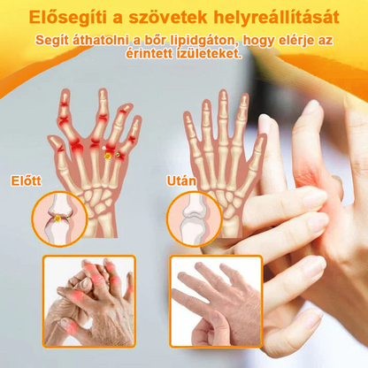 ✅ Hivatalos áruház: Ourlyard™ Magnéziumolaj és Mézes Ízületjavító Spray 👨‍⚕️ Jóváhagyva a Magyar Gyógyszerészeti és Egészségügyi Minőség- és Szervezetfejlesztési Intézet (OGYÉI) által. 🔥🔥🔥