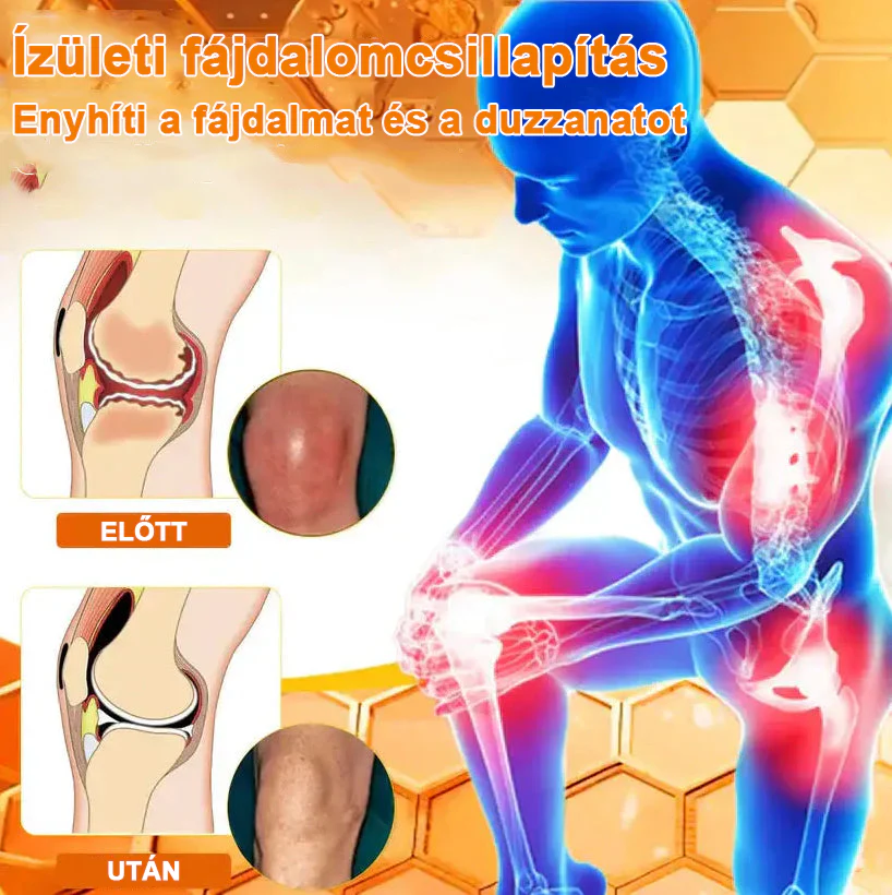 ✅ Hivatalos áruház: Ourlyard™ Magnéziumolaj és Mézes Ízületjavító Spray 👨‍⚕️ Jóváhagyva a Magyar Gyógyszerészeti és Egészségügyi Minőség- és Szervezetfejlesztési Intézet (OGYÉI) által. 🔥🔥🔥